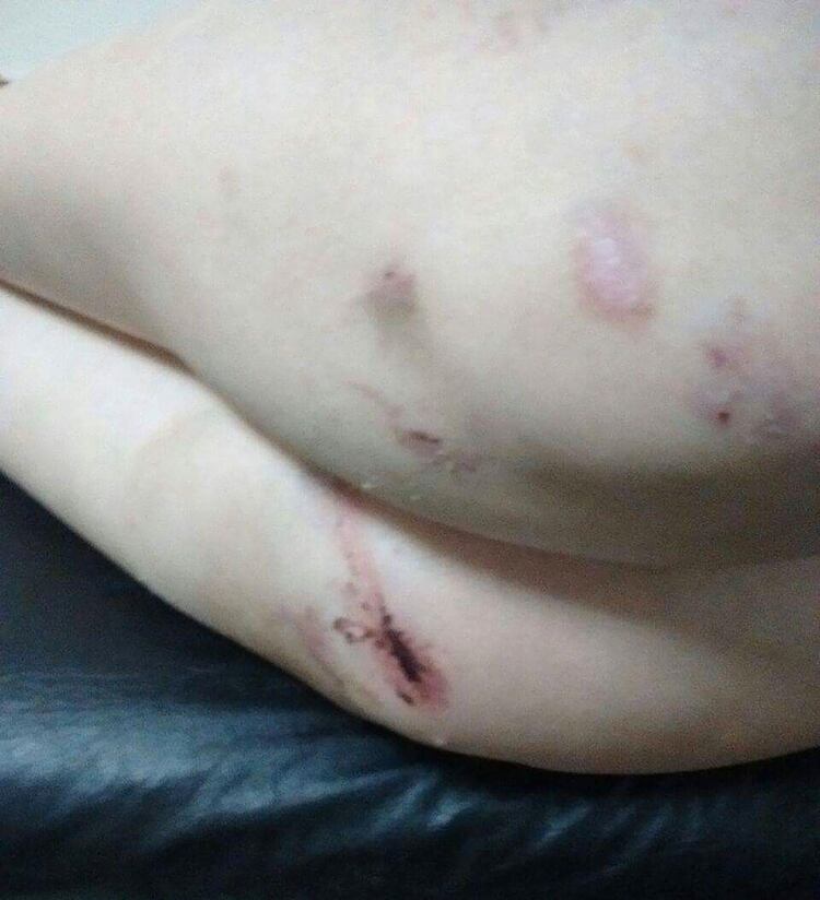 Rinaldi teme morir si liberan al acusado.