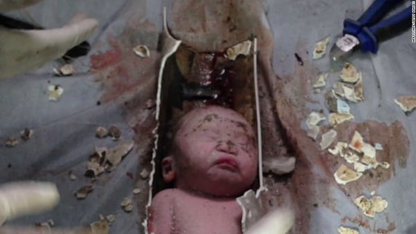 Los plomeros descubrieron un bebÃ© de dos dÃ­as habÃ­a sido arrojado por el inodoro (CortesÃ­a)