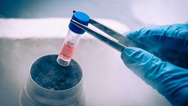 Las células madre tienen propiedades que las hacen únicas, como su capacidad de autogenerarse (Shutterstock)