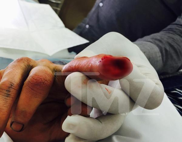 El dedo cortado de Johnny Depp (TMZ)