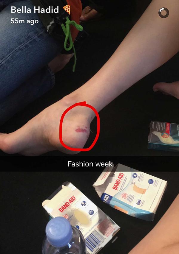 En su cuenta de Snapchat Bella Hadid mostr cmo qued su pie tras el incidente
