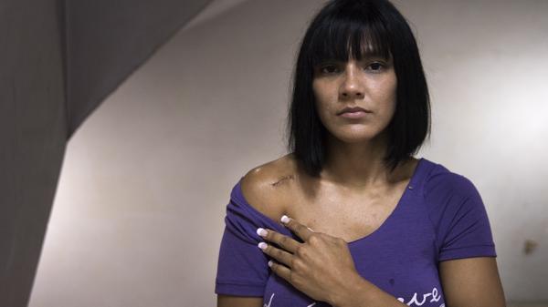 Su pareja, según su relato, también la acuchilló en el hombro. (Adrián Escandar)