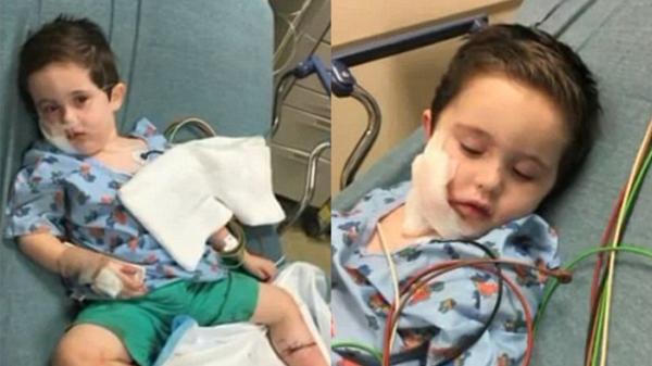 El nio de dos aos fue hospitalizado con profundas heridas en el rostro y una pierna