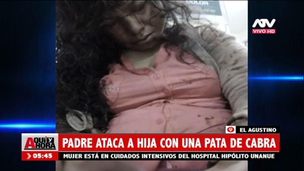 Perú: padre atacó a su hija con una pata de cabra y la dejó al borde ... - Infobae.com