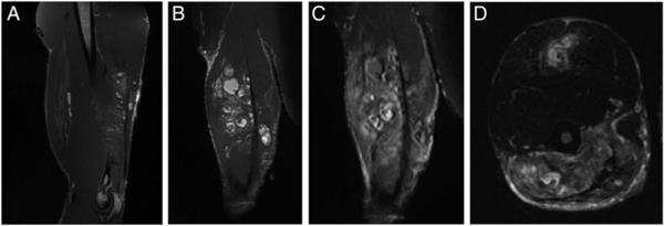 Los estudios hechos al joven de 25 años en el Ealing Hospital de Londres