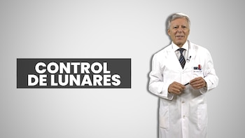 Cómo controlar sus lunares para