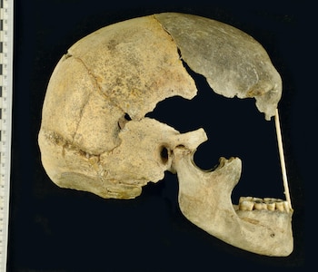 Un cráneo de un individuo del sitio Zlatý kůň. Crédito Marek Jantač/Anthropology Department of the National Museum