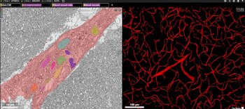 Mapa cerebral Google Harvard
