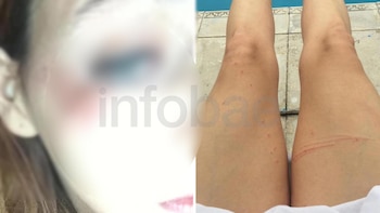 Una de las víctimas, con