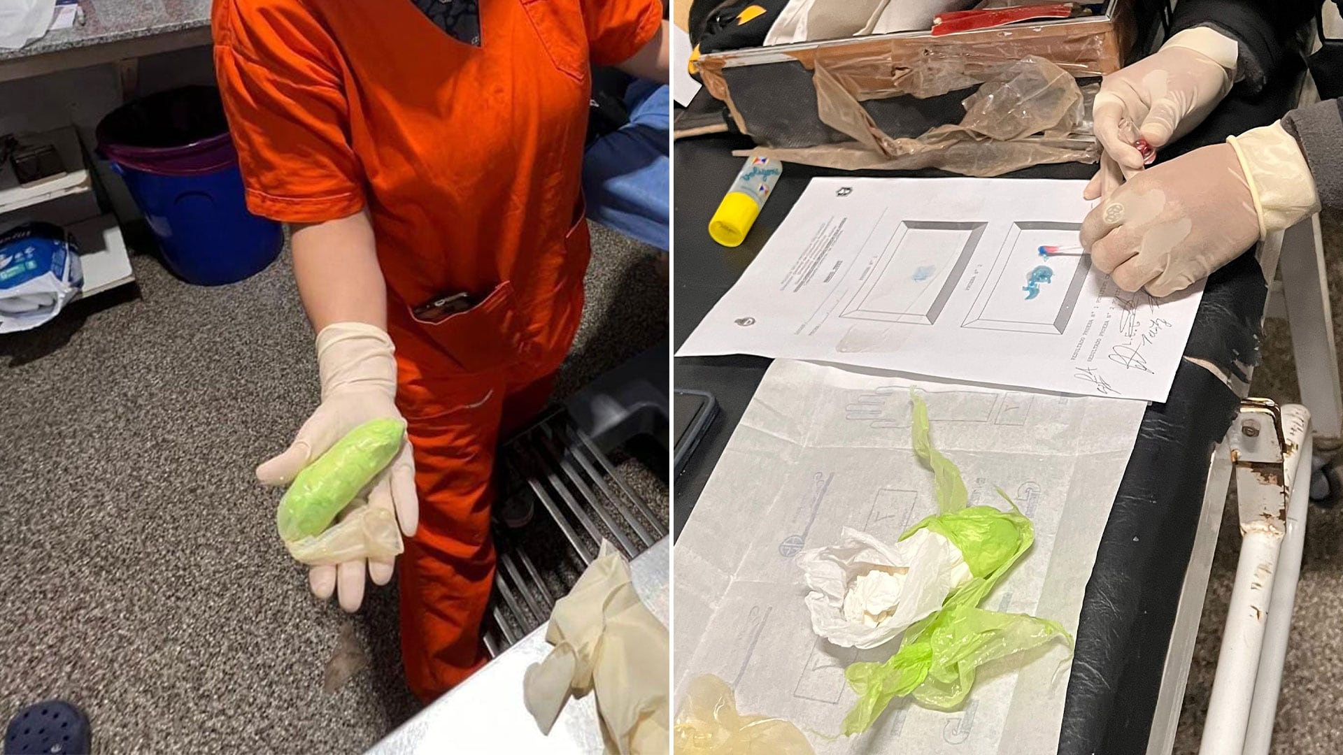 Una médica encontró un envoltorio cilíndrico en las partes íntimas de la sospechosa