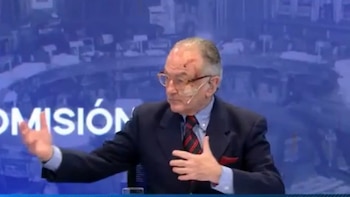 Hombre con saco oscuro, camisa celeste, corbata y gafas, con heridas en la frente y el pómulo derecho, en un estudio de televisión de fondo azul