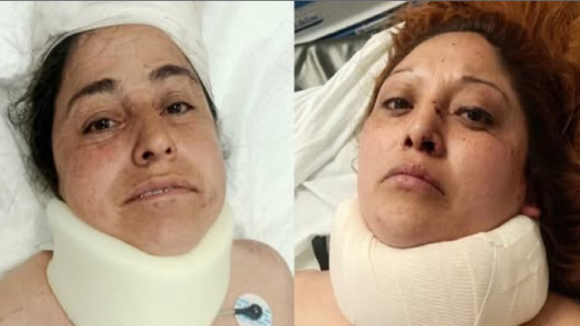 Accidente Acapulco Guerrero familia Xonacatlán (especial)