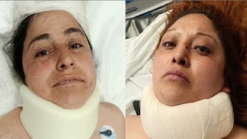 Accidente Acapulco Guerrero familia Xonacatlán