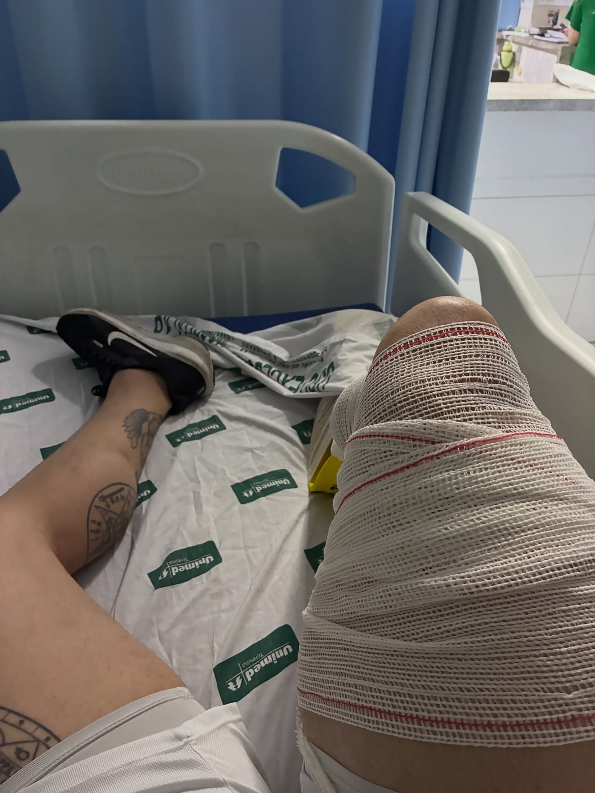 El fisicoculturista en una cama de hospital con una de sus piernas fuertemente vendada (@ranierilf)
