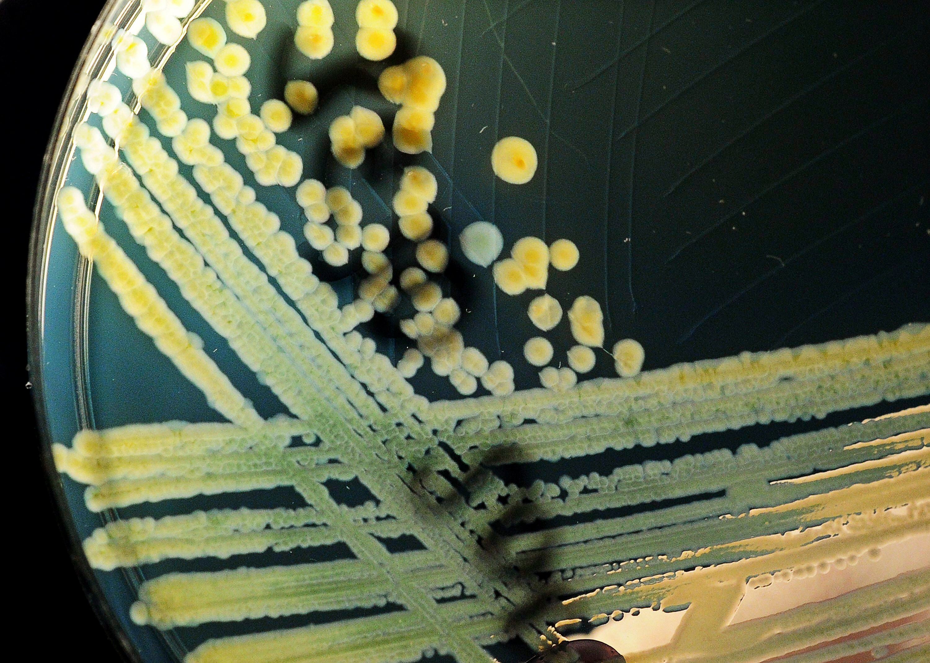 El uso de tetraciclinas permite bloquear bacterias patógenas sin afectar a especies beneficiosas como Bacteroides dorei (EFE/JULIAN STRATENSCHULTE/ Archivo)