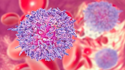 5 tratamientos contra el linfoma alternativos a la quimioterapia y sus efectos a largo plazo