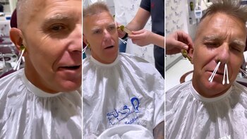 Alejandro Fantino volvió a depilarse