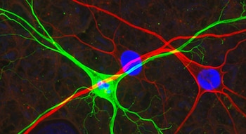 El trasplante de neuronas humanas