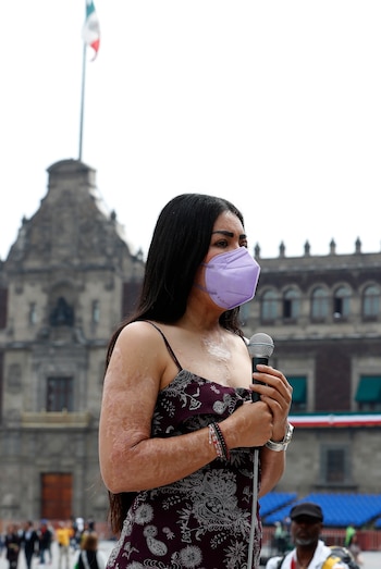 El ataque con ácido sulfúrico contra María Elena Ríos ocurrió el 9 de septiembre de 2019 en el municipio de Huajuapan de León. EFE/Mario Guzmán