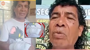 Cachay revela la secuela de su accidente en Olmos y el costo de 25 mil soles para salvar su muñeca