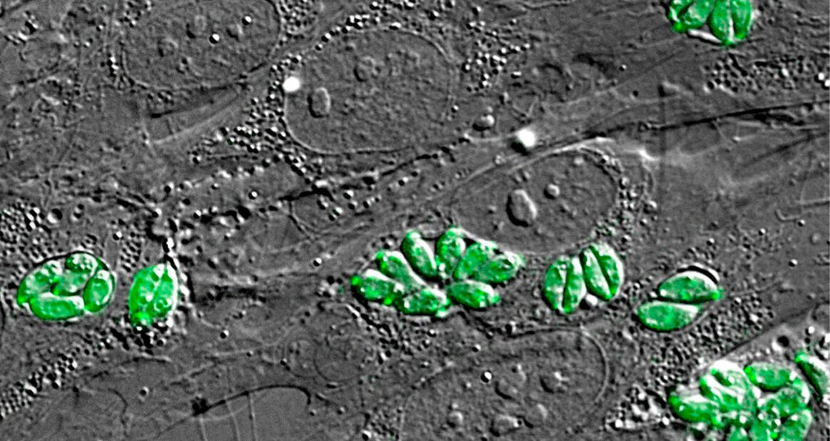 Imagen de archivo: Imagen intracelular al microscopio del parásito Toxoplasma gondii, causante de la toxoplasmosis. (ISCIII/Europa Press)