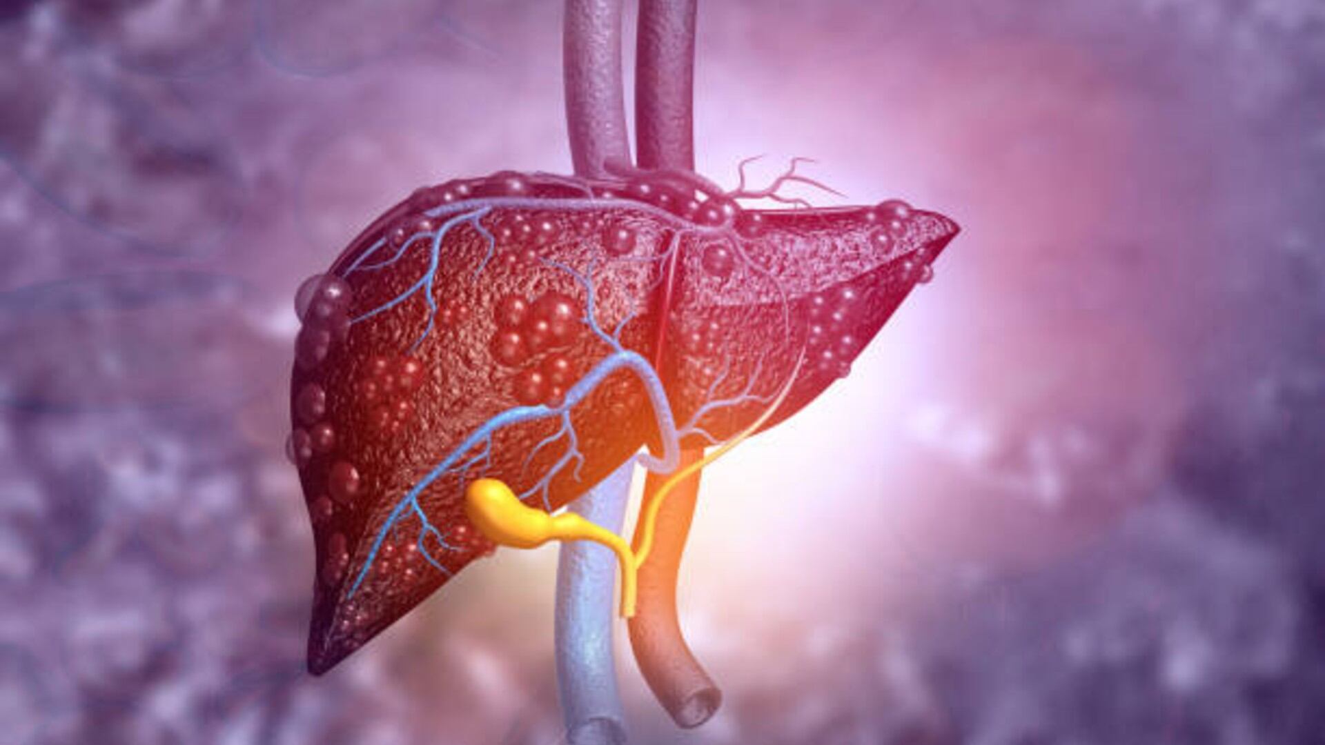 Esta enfermedad puede progresar si no se trata a tiempo. Foto: (iStock)