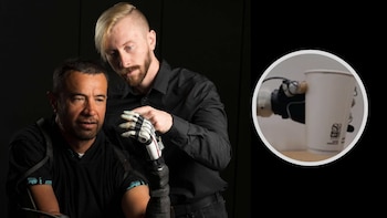 La prótesis del futuro: usan