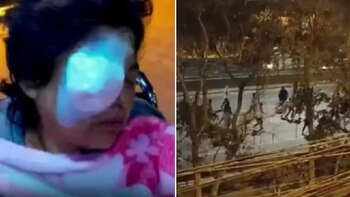 Mujer pierde la vista del