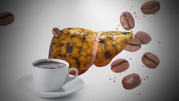 Hígado graso y el café: