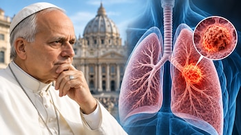 Cáncer de pulmón: por qué la tos persistente, ronquera y falta de aire son síntomas de alerta