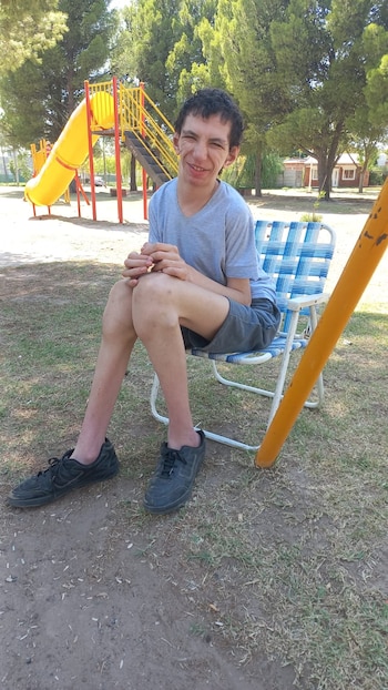 El síndrome de Weaver también impacta en la motricidad y en el habla. Hace un año que Yamir no puede caminar, y hay días en los que la rigidez de su cuerpo lo dejan completamente inmóvil.