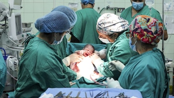 Madre trasplantada de corazón logró dar a luz por primera vez en el Perú