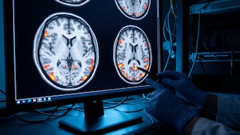 Alzheimer: vinculan la acumulación de tau con alteraciones del sueño profundo y la memoria