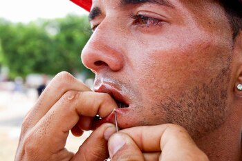 A migrant gets his mouth