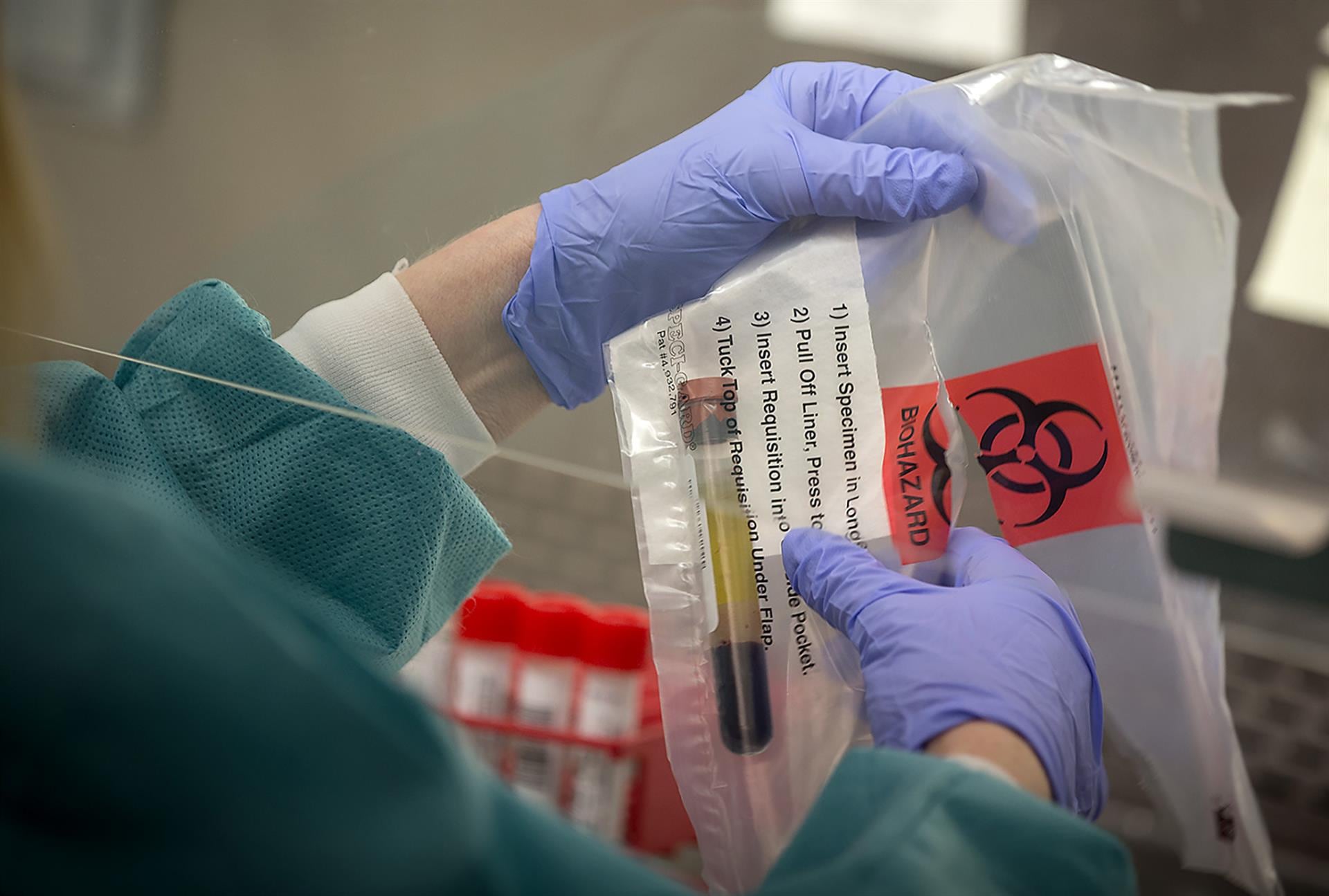 Carolina del Sur registra ya el peor brote de sarampión de los últimos 25 años en EEUU