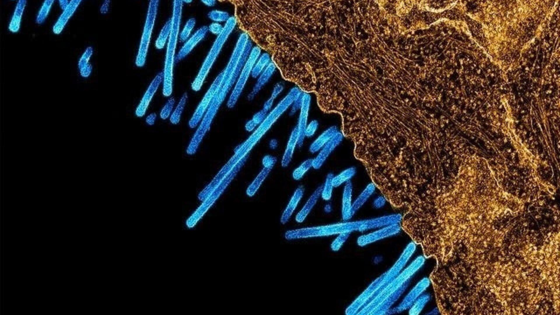 Micrografía electrónica de transmisión coloreada que muestra las partículas del virus de la gripe porcina (azul) unidas a una célula (naranja). (NIAD)