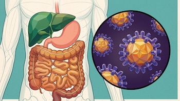 Costa Rica reporta 772 casos de hepatitis A en 2026, concentrados en San José