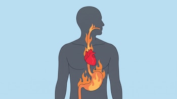 Silueta gris de un torso humano sobre fondo azul con el estómago y el esófago dibujados con fuego y un corazón rojo en el centro.