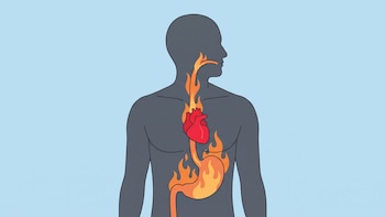 Agruras por la noche: 5 cambios en tu cena que previenen el reflujo