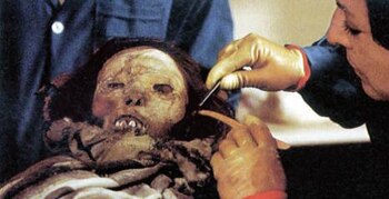 Expertos realizaron más de una