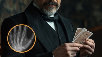 Hombre se implanta un chip