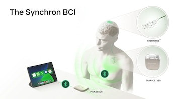 La propuesta de Synchron es