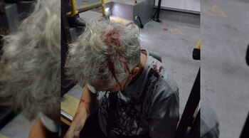 Las heridas que sufrió la