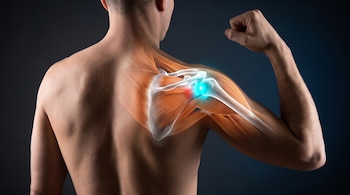 Espalda masculina de perfil posterior con el brazo levantado y un esquema gráfico del omóplato, músculos e iluminación azul en la articulación.
