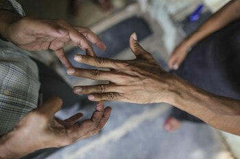 La lepra se cura con