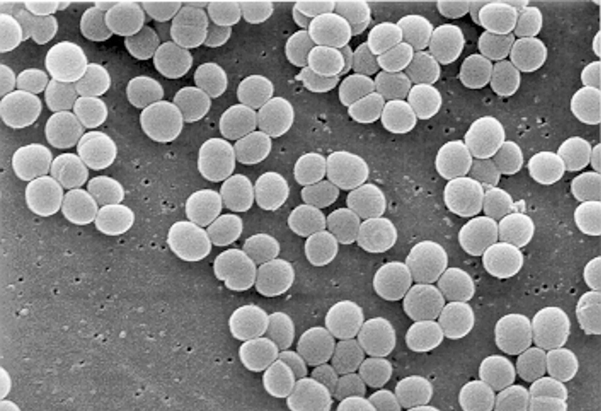 Esta micrografía electrónica muestra grupos de la bacteria esférica Staphylococcus warneri, que provocó la osteomielitis que derivó en la amputación parcial de la pierna derecha de la mujer mendocina