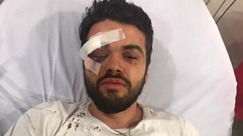 Jonathan Castellari fue golpeado por