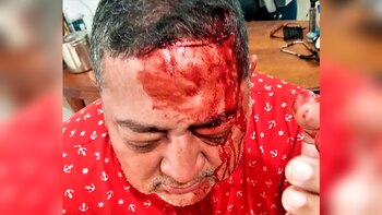 El brutal ataque a un