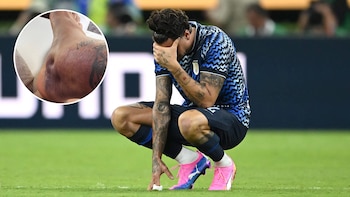 “Jamás del lado de los que dicen barbaridades”: Giménez publicó fotos de su lesión y difundió un crudo descargo tras la eliminación de Uruguay del Mundial