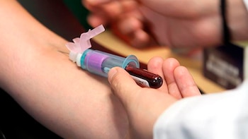 El IMSS incorpora terapias innovadoras para atender pacientes con hemofilia, enfermedad hereditaria